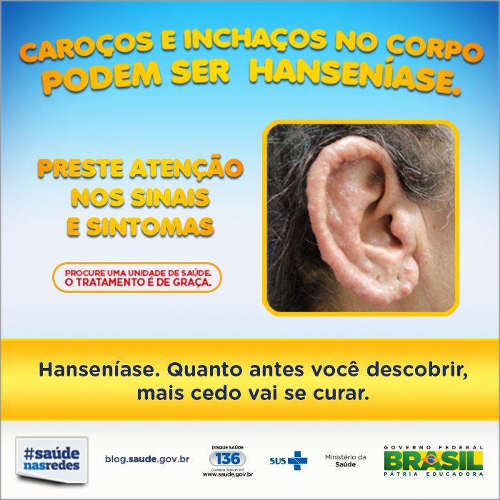 Campanha conscientiza sobre sintomas e tratamento da hanseníase -  Prefeitura de Limeira